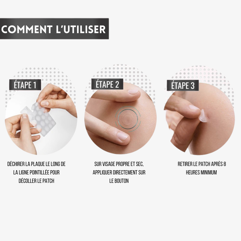 Patch Boutons Hydrocolloïde X360