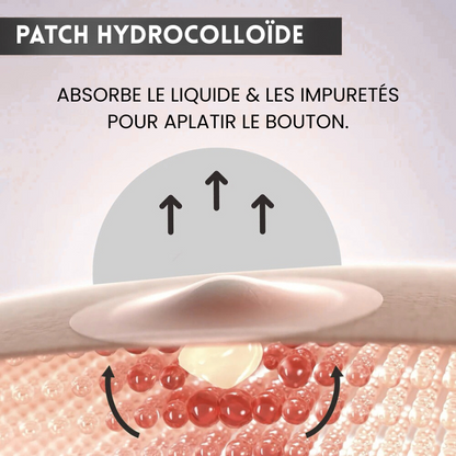 Patch Boutons Hydrocolloïde X360